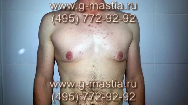 Пациент до операции