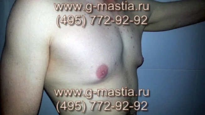 Женская грудь