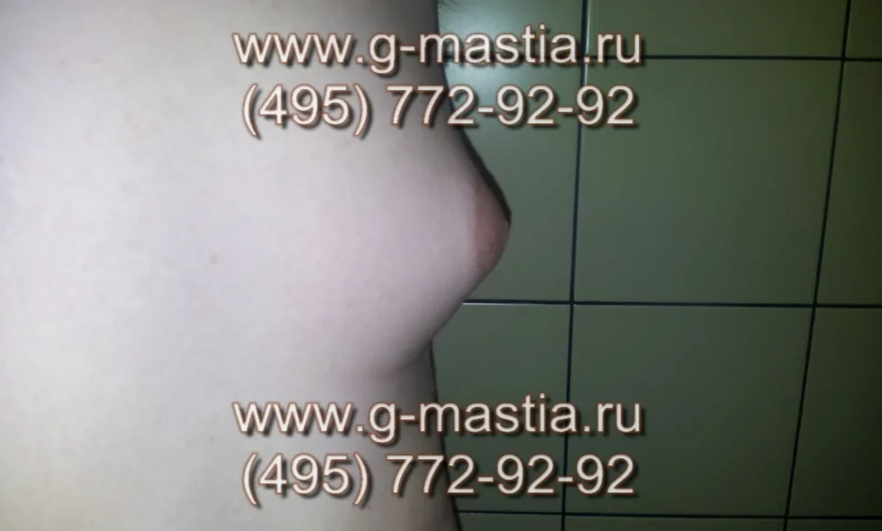 Грудь похожа на женскую