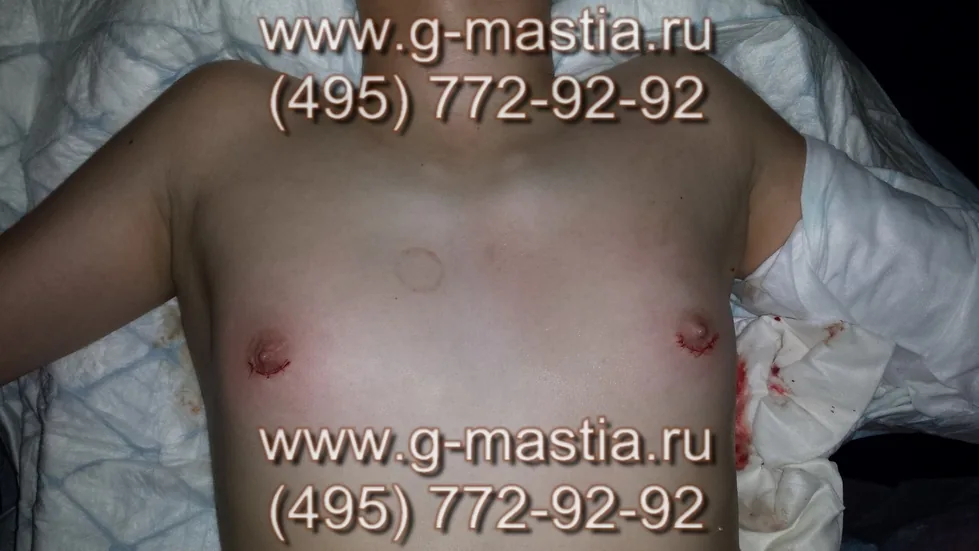 Операция завершена