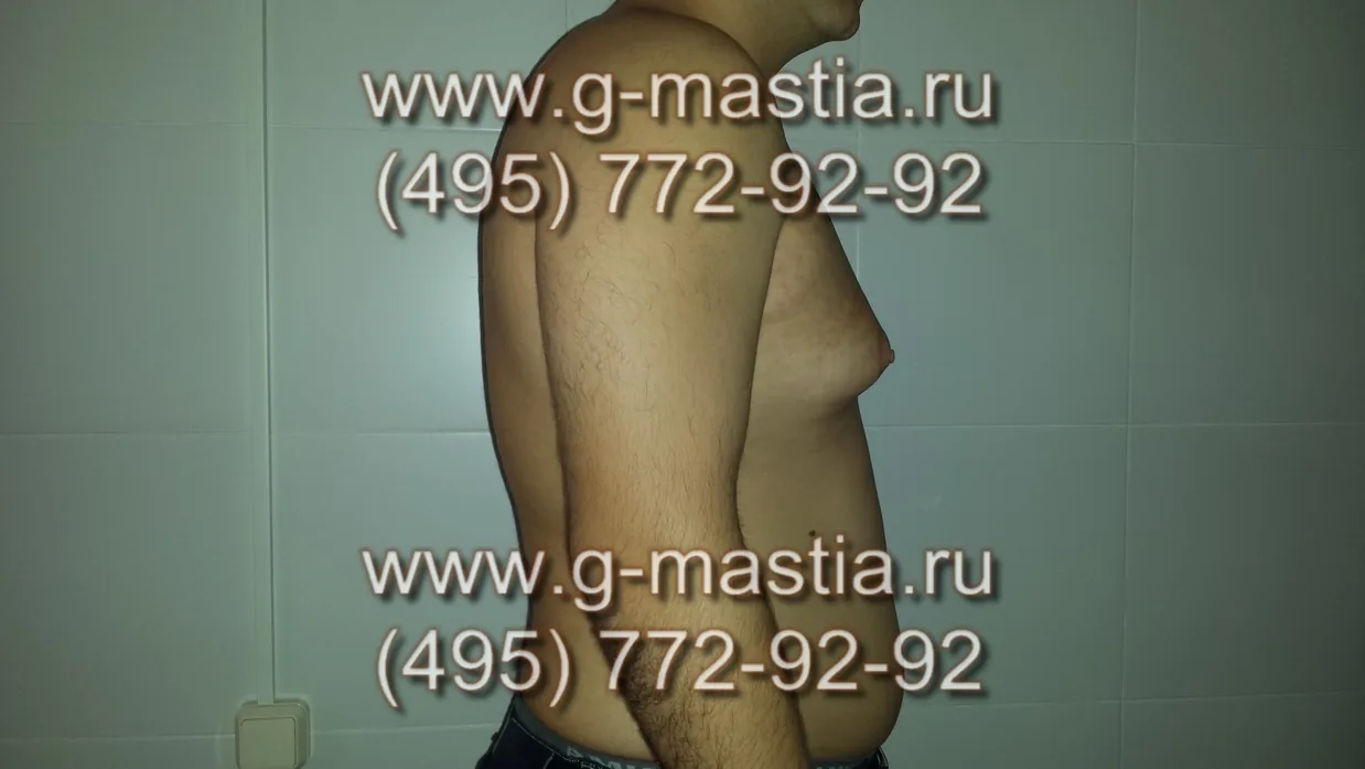 Пациент до операции