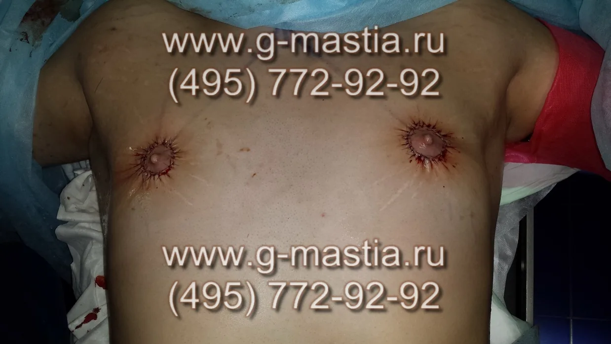 Операция завершена