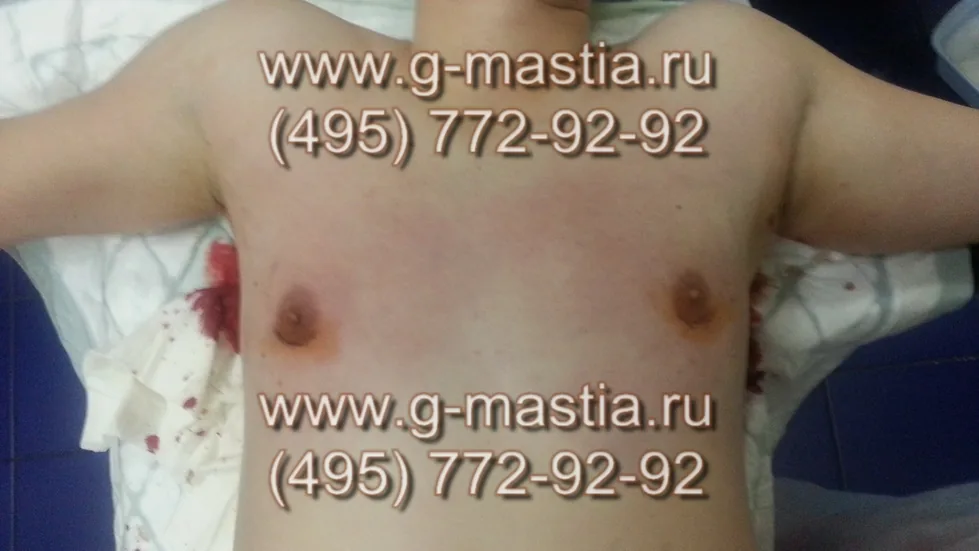 На операционном столе, операция закончена