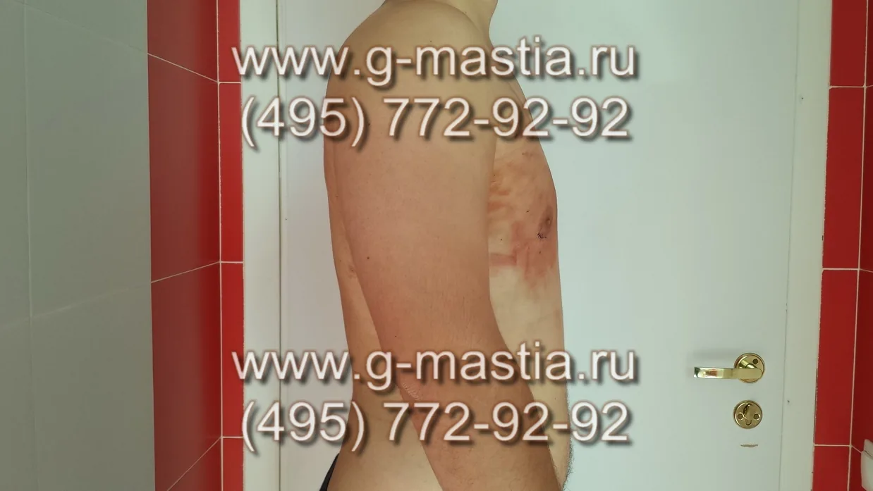 На перевязке после операции