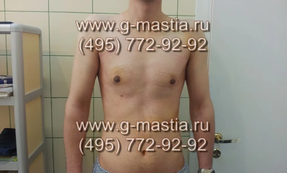 Пациент на осмотре и перевязке на следующий день