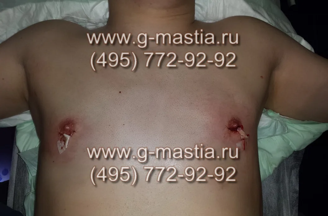 Операция завершена