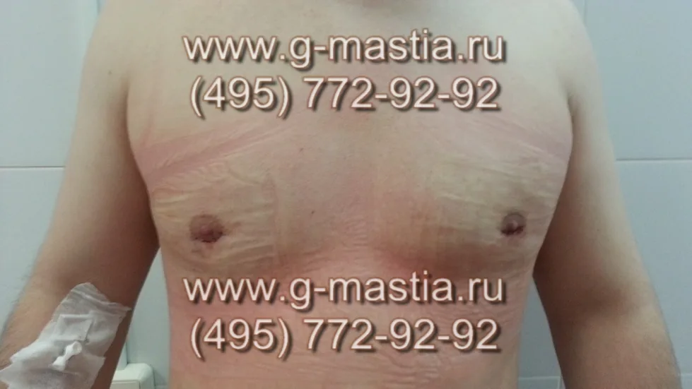 На перевязке все в норме
