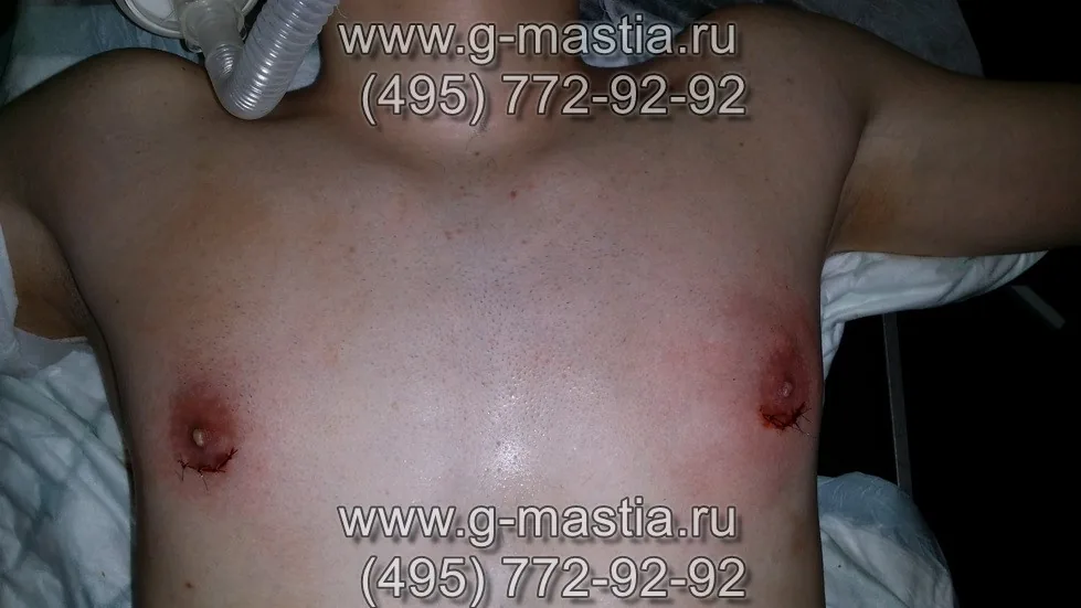 Операция завершена