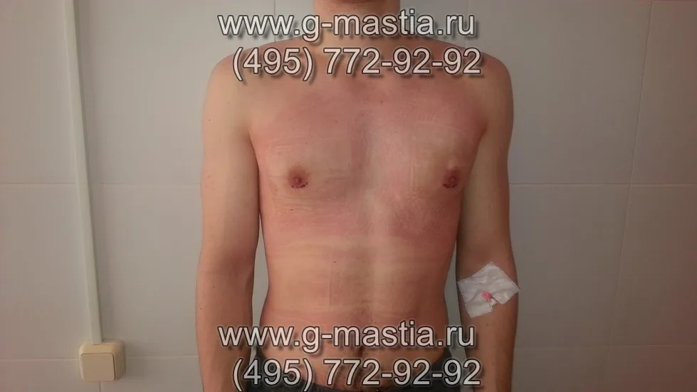 На перевязке на следующий день
