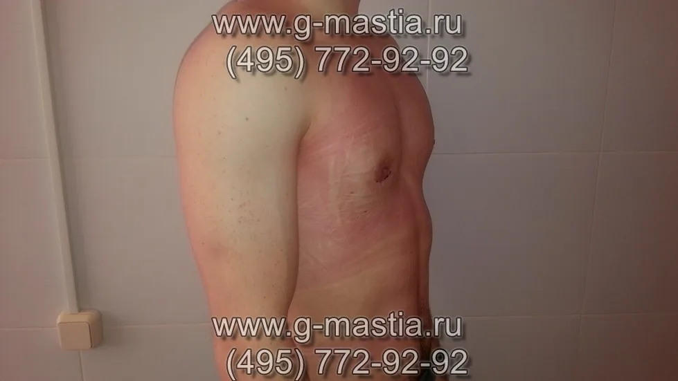 На перевязке на следующий день