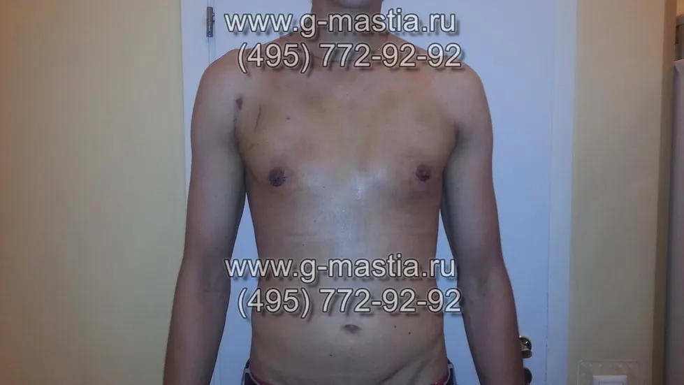 Пациент на перевязке на следующий день после операции