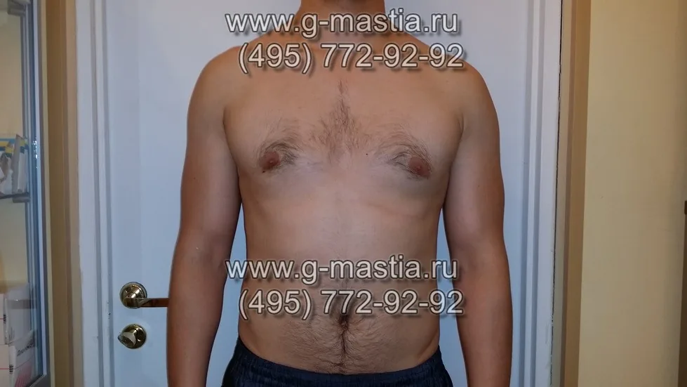 Пациент на осмотре через 6 месяцев