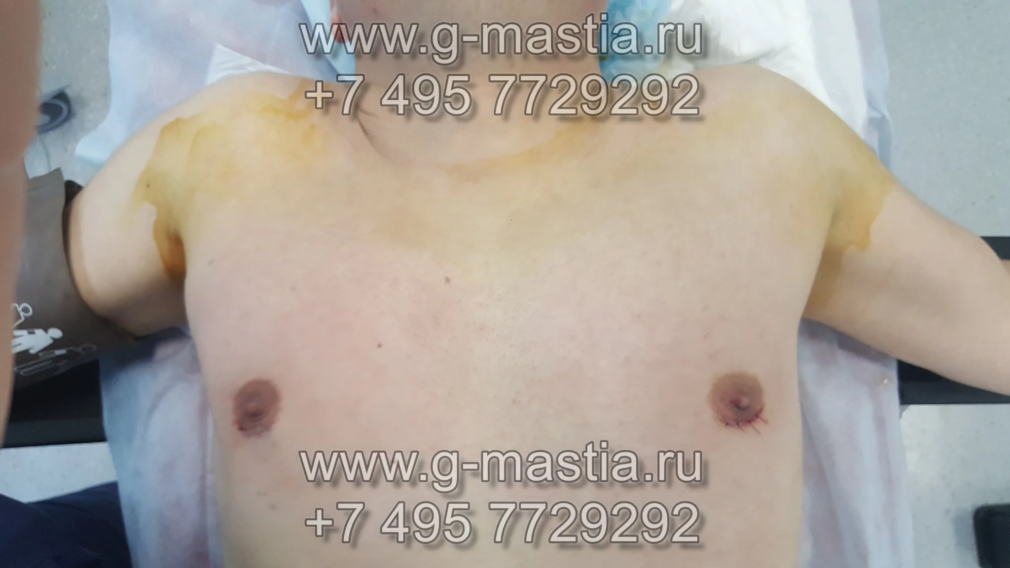 Пациент после операции