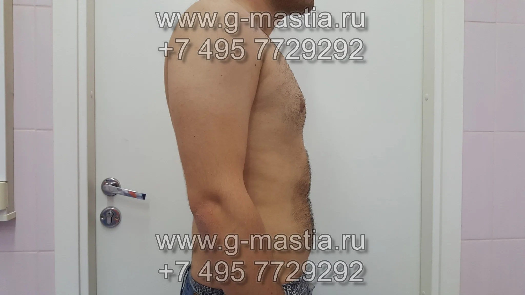 Через 20 дней после операции