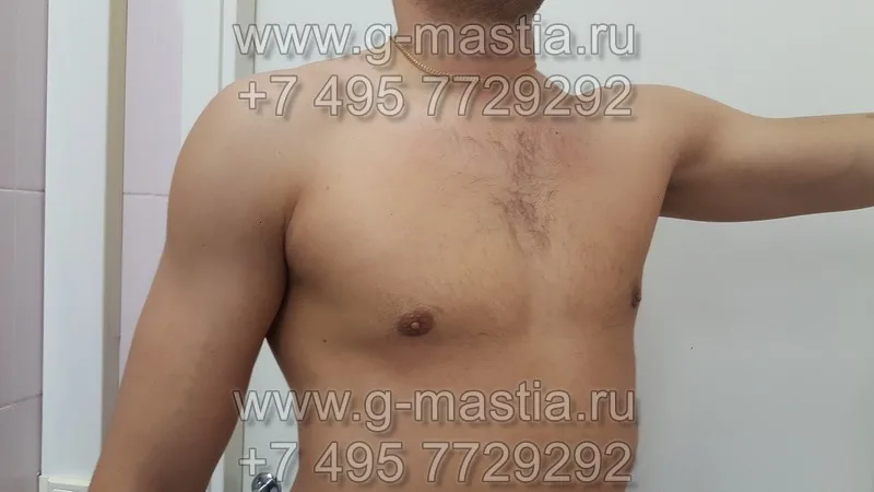 Результат операции через месяц