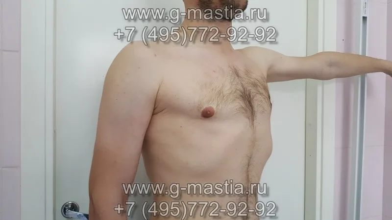 Результат операции через год