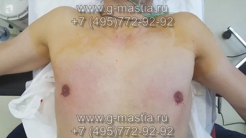 Ход операции
