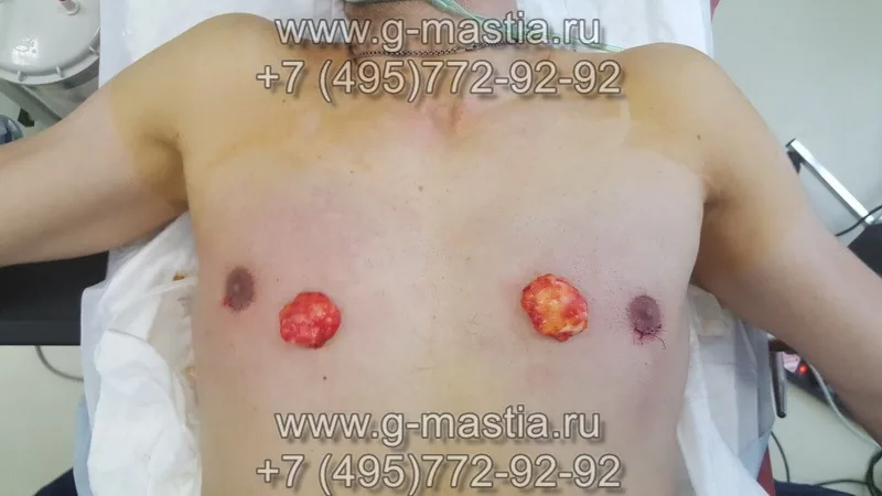 Ход операции