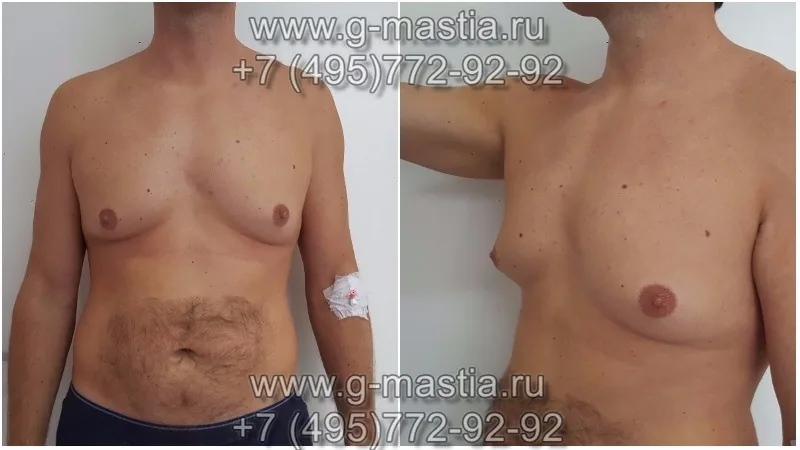 Пациент на осмотре в клинике