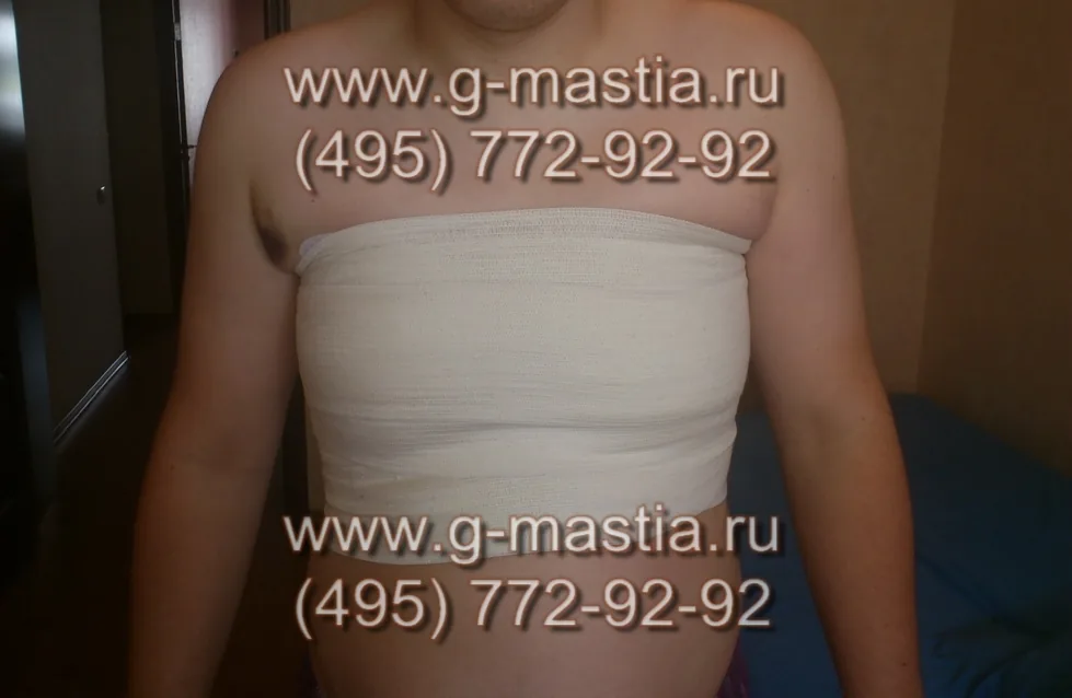 Фото пациента из дома. Бинтование грудной клетки.