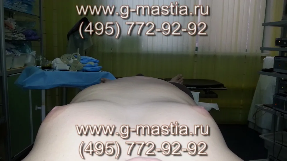 Пациент на операционном столе
