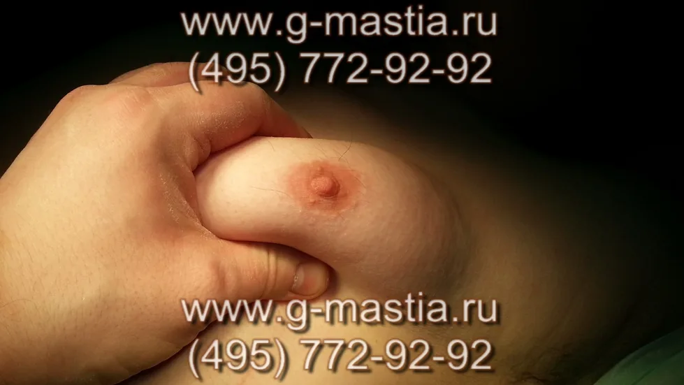Пациент на операционном столе перед операцией