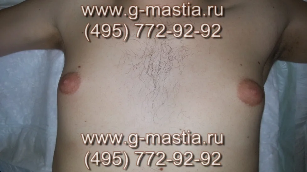Пациент на операционном столе