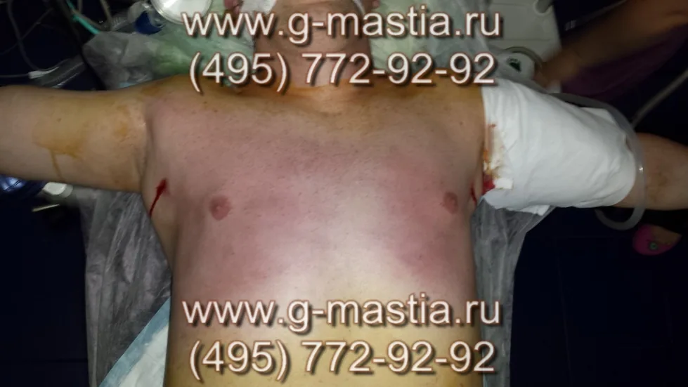 Операция закончена