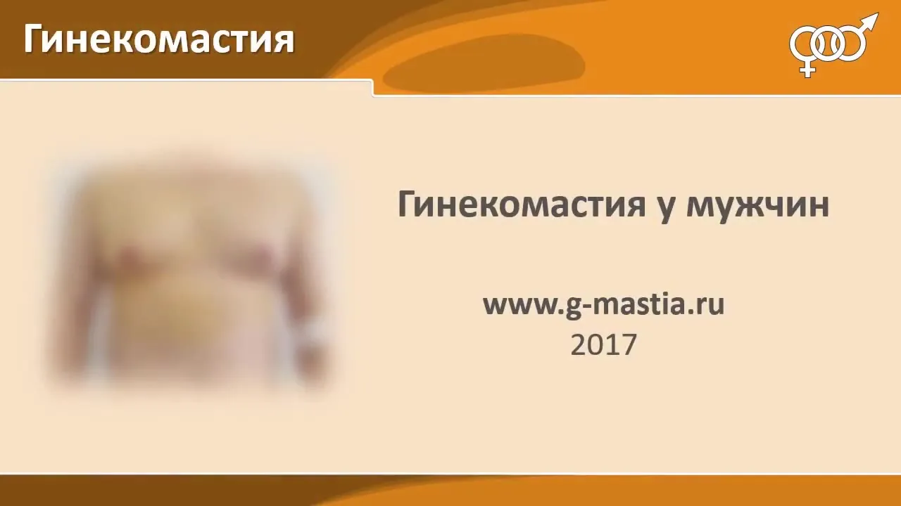 Липомастия у мужчин