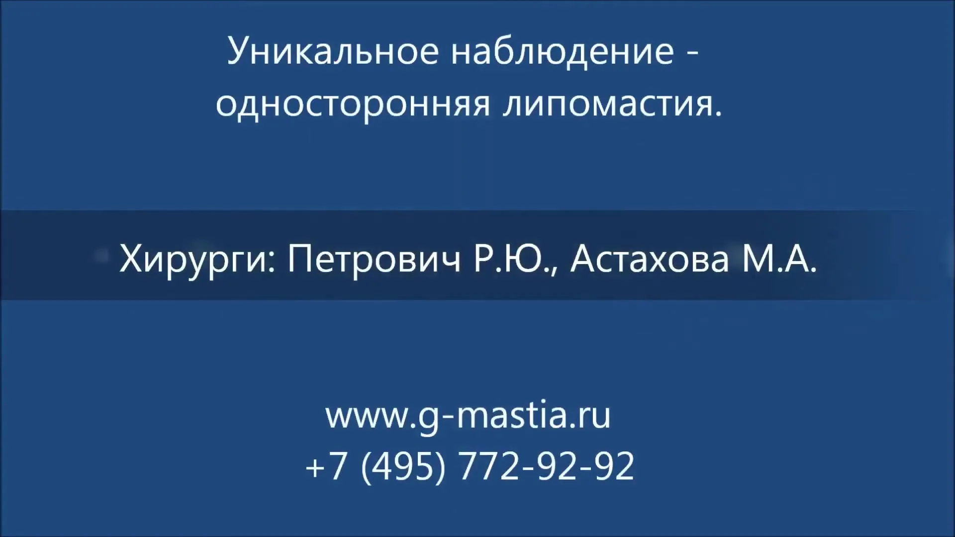 Односторонняя липомастия